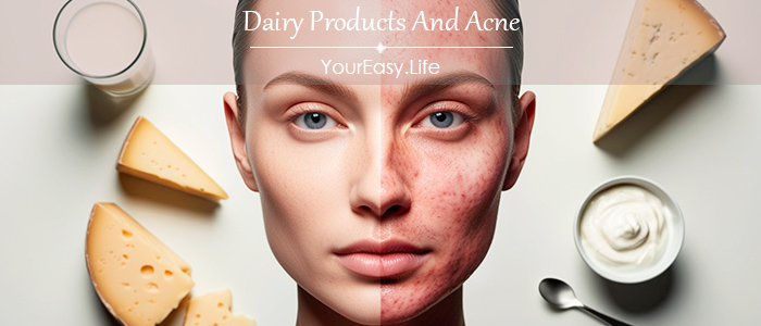 Dairy Products And Acne | YourEasy.Life